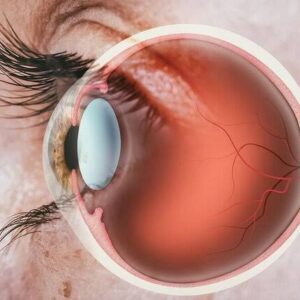 بازیابی بینایی با کاشت سلول بنیادی
