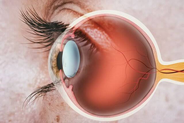 بازیابی بینایی با کاشت سلول بنیادی