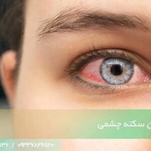 سکته چشمی علل، علائم