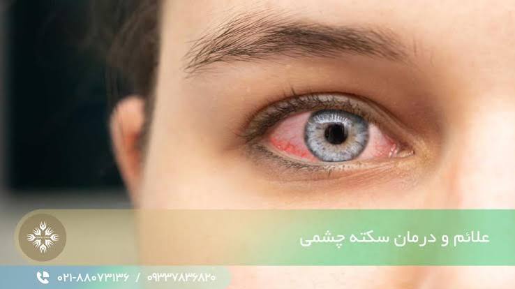 سکته چشمی علل، علائم