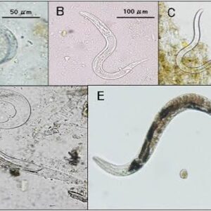 Strongyloidiasis (استرونژیلوئیدیازیس) در ایران